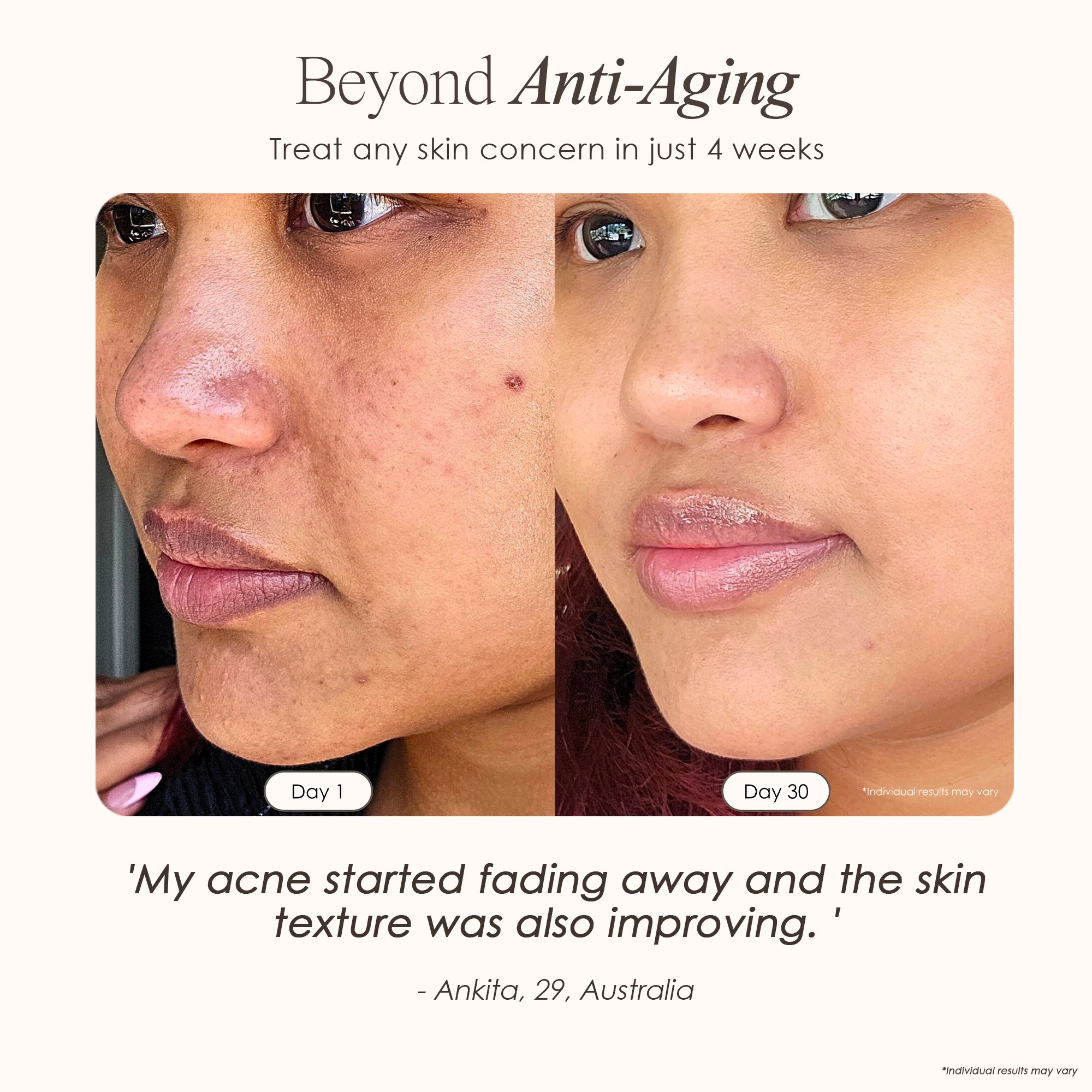 visible results after 30 days of using the High-Frequency Wand