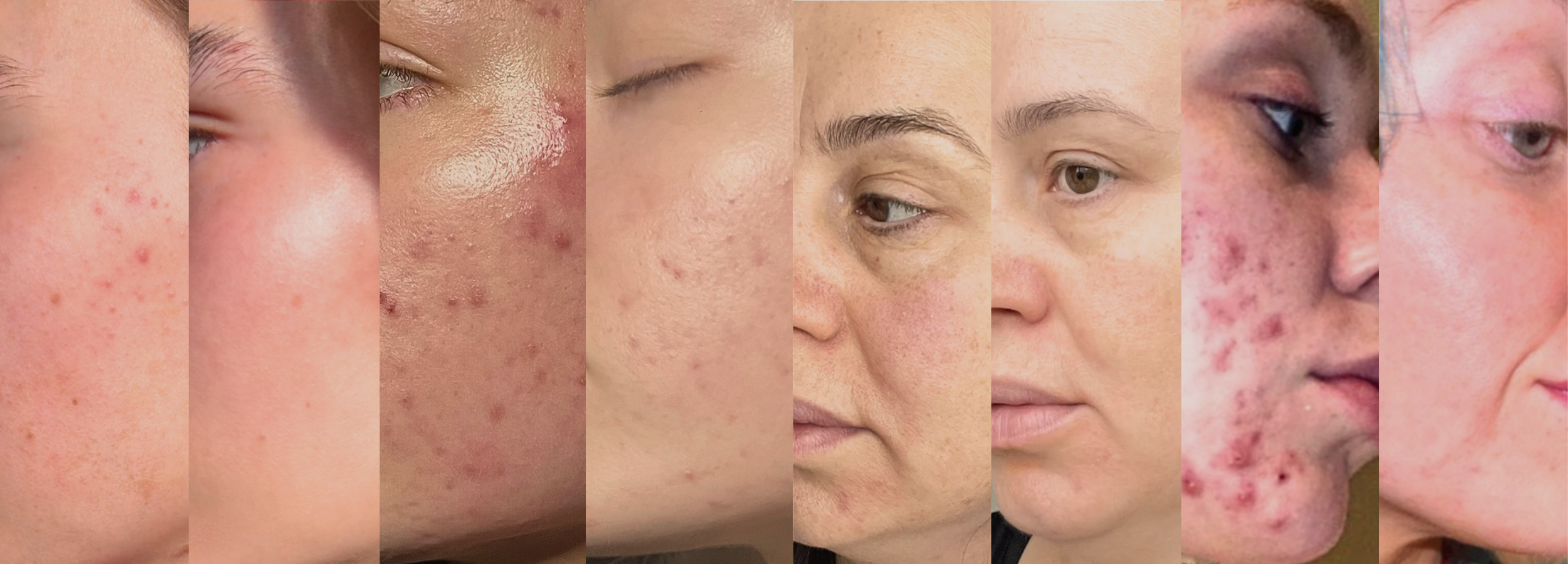 banner of before and after users